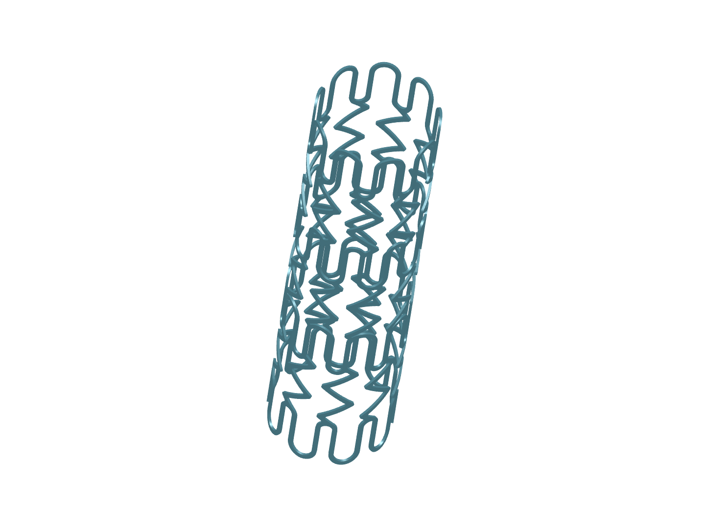 stent 1 image