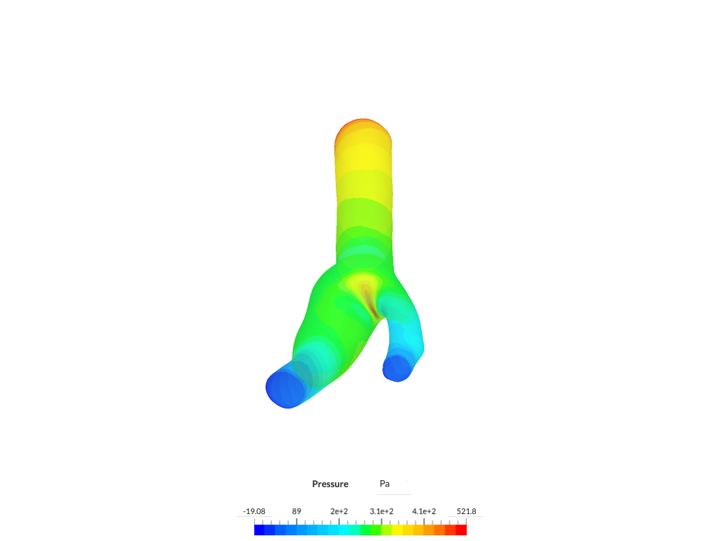 Carotid Bifurcation image