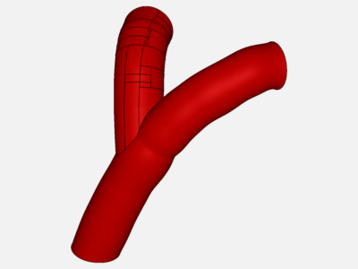 Vascular Bifurcation image