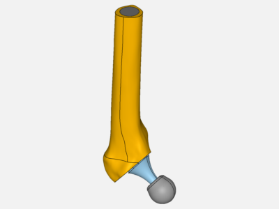 Group 6 Hip Implant_Lawrie image