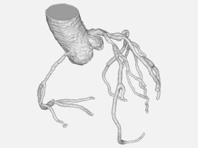 Coronary Artery image