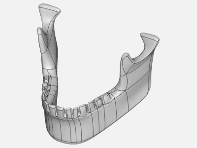 Skull Assembly image