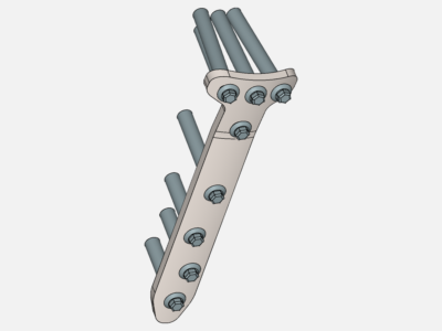 Proximal tibial plate image