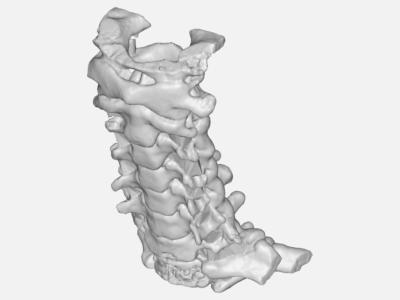 étude contraintes cervicales image