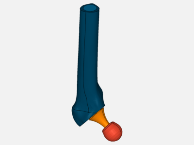 hip joint prosthesis image