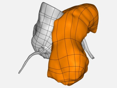 Pulmonary Stent image