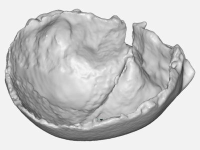 Occipital bone image