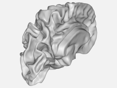 Brain image