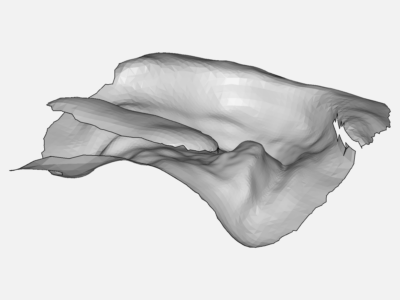 complete denture image