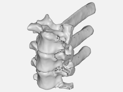 Vertebra Toracica image