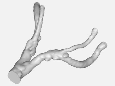 aorta image