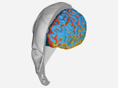 BLood brain barrier - Copy image