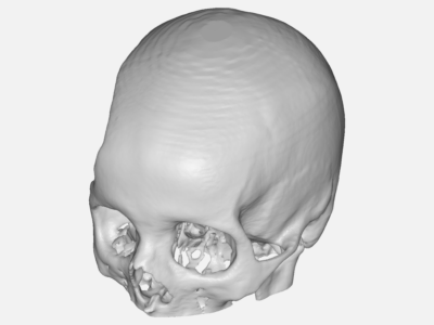 skull image