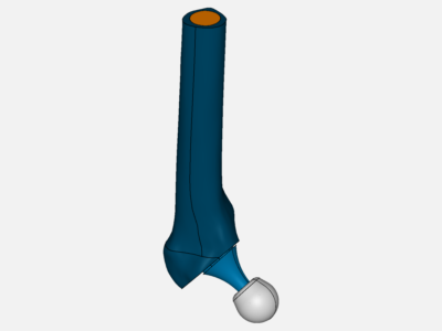 Hip Joint Prosthesis - Kevin image