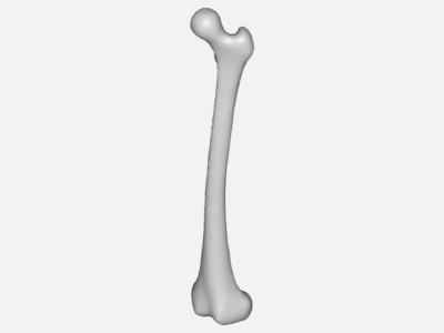 femur bone image