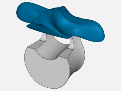 vertebra image