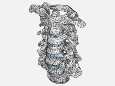 Spine_Orthoses_Project - Copy image