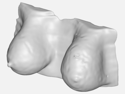 Reconstruction of Breast orientation in Supine position from MRI scans acquired in the Prone Position image