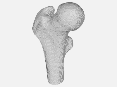 Femur_Test image