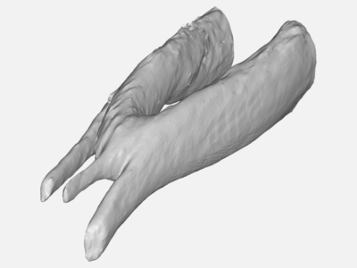 Aortic Coarctation Aorta Model image