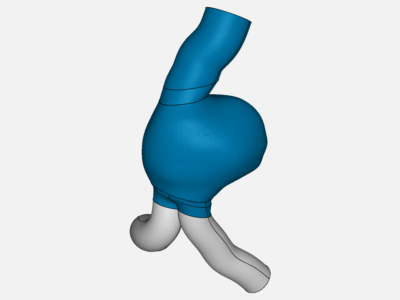 Flow Aneurysm Stentgraft image