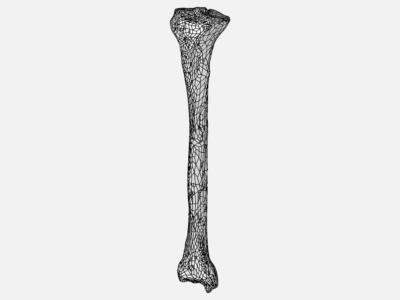 Tibia image