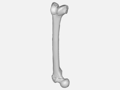 femur image