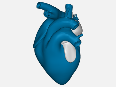 3D Heart Blockage image