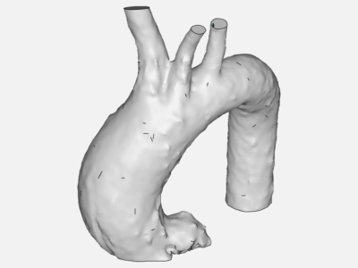 Aorta image