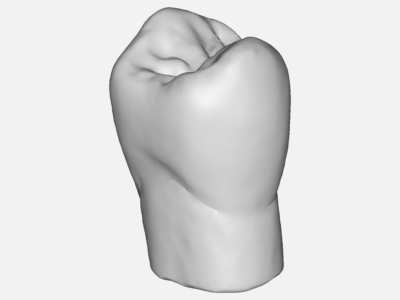 Tutorial 1: Connecting rod stress analysis image