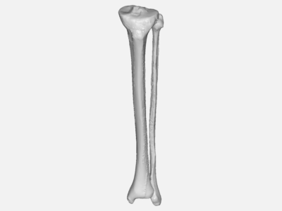 Human bone stress analysis image