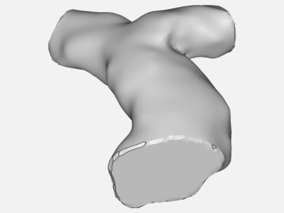 preop patient 1 image