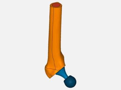 Hip joint prosthesis image