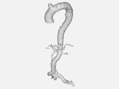 aorta simulation image