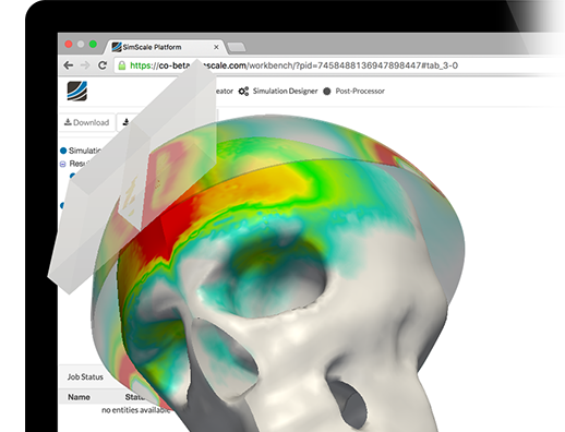 https://www.simscale.com/wp-content/uploads/2017/03/Healthcare_skull.png